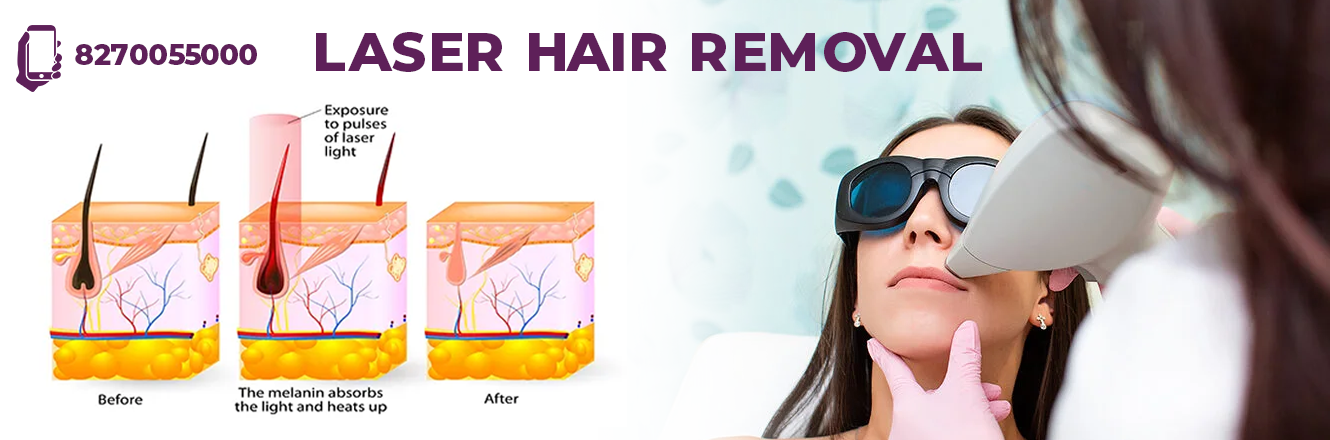  Laser Hair Reduction  Clinic 