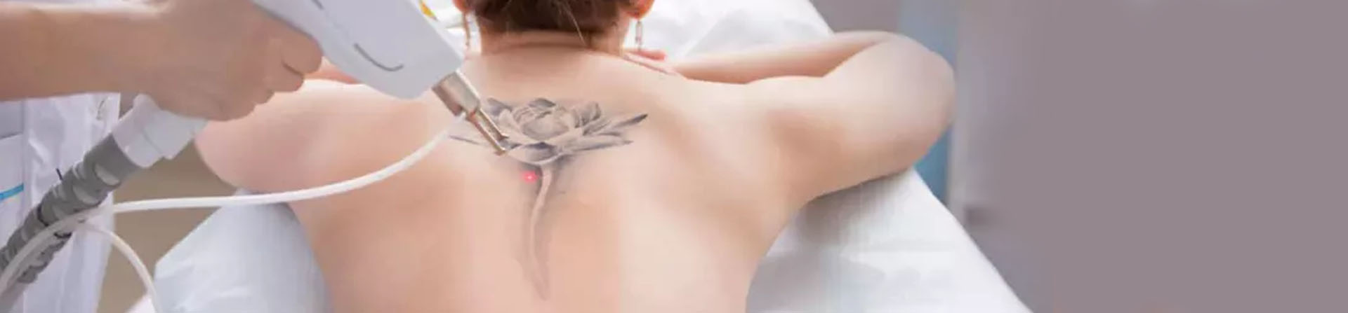 Best Laser Tattoo Removal Clinic near Apollo Hospital