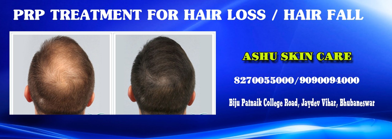 Best PRP Treatment for Hair in Bhubaneswar