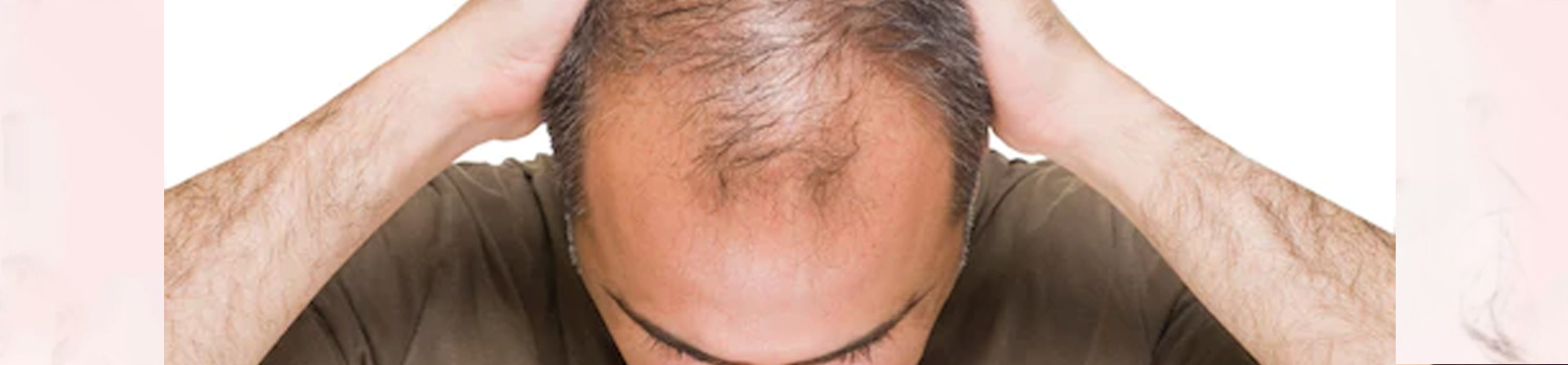 Best hair fall problem treatment clinic in Odisha