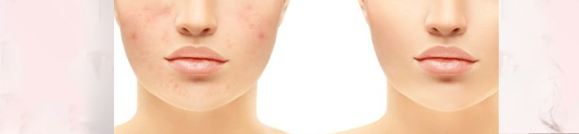 Best Atopic Dermatitis Treatment Clinic in Bhubaneswar